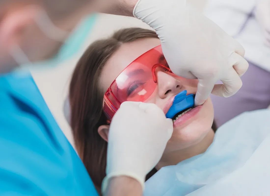 What is Fluoride Treatments