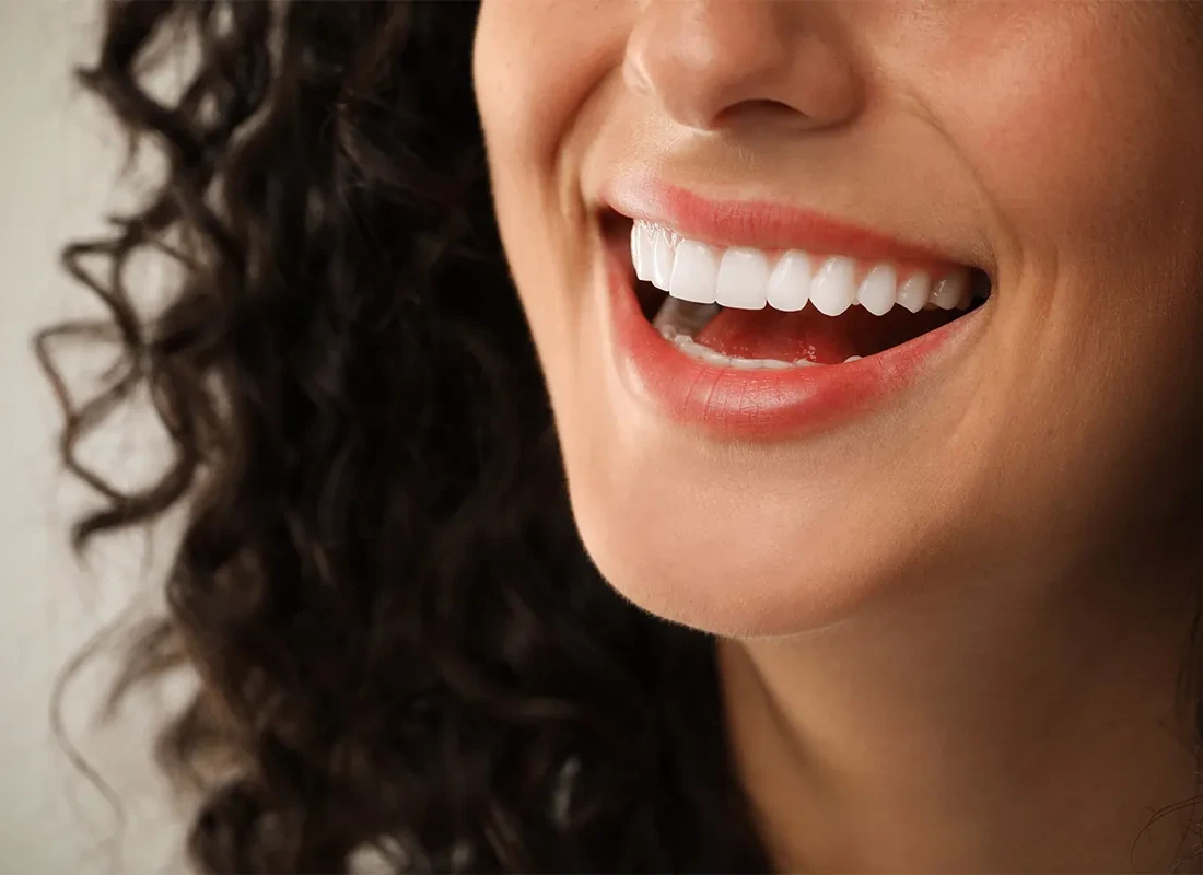 Gum Contouring