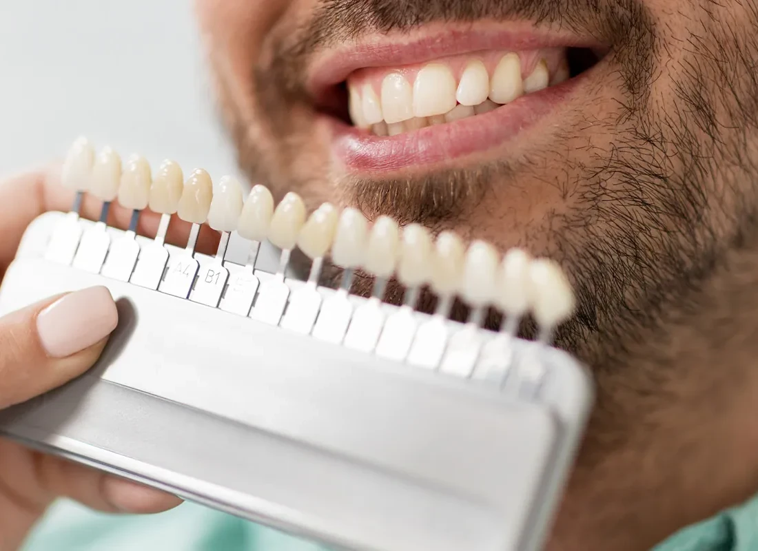 A Quick & Easy Smile Makeover? Yes, Please!