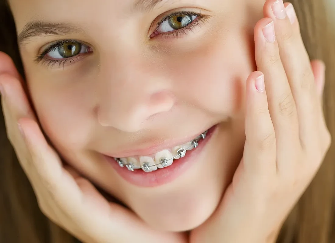 Fastbraces at Muse Dental Studio