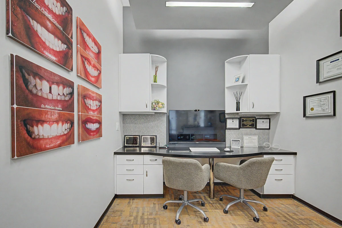 Veneer shade display