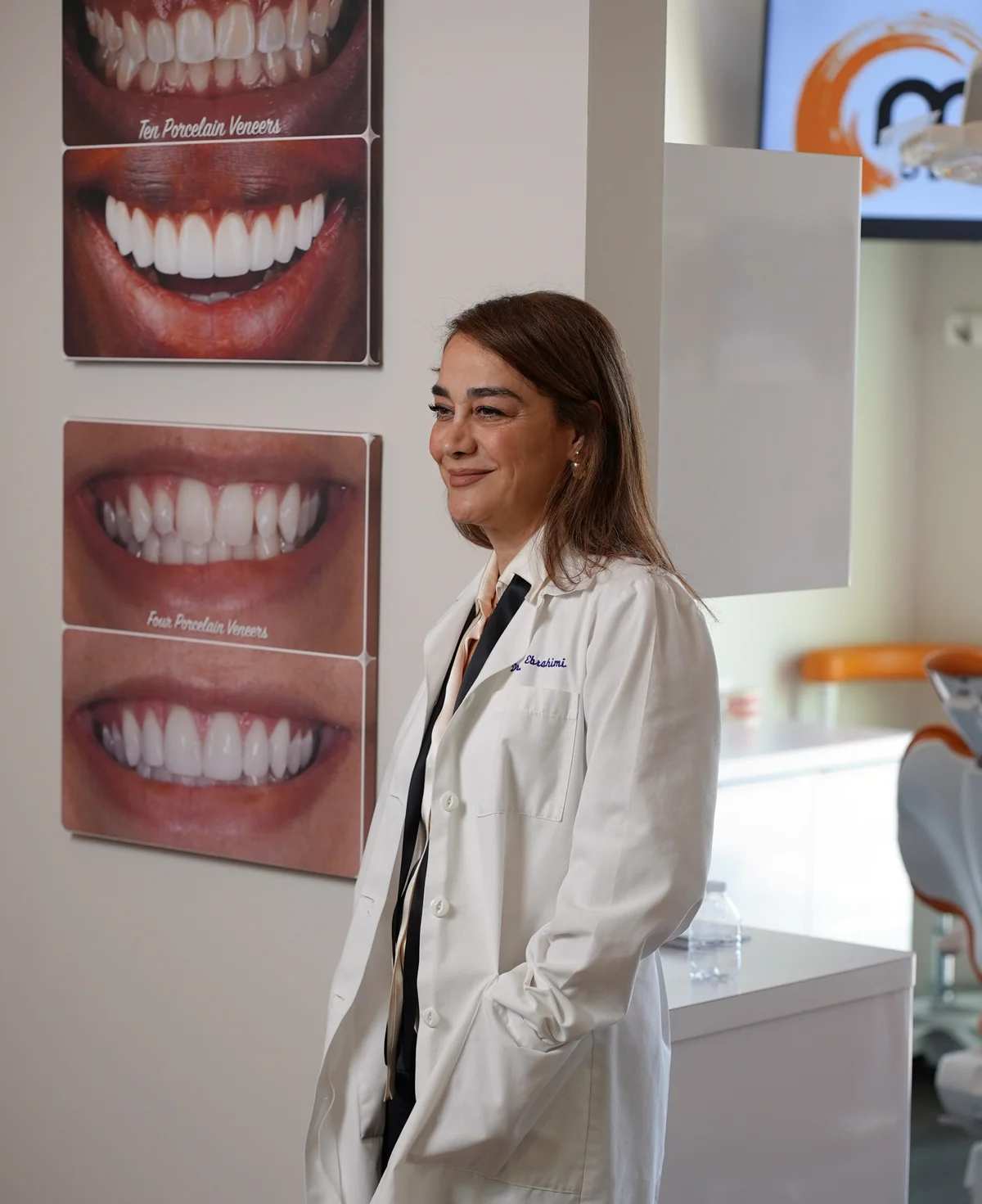Veneers at Muse Dental Studio