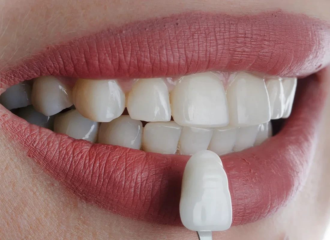 Learn About This Exciting Dental Treatment
