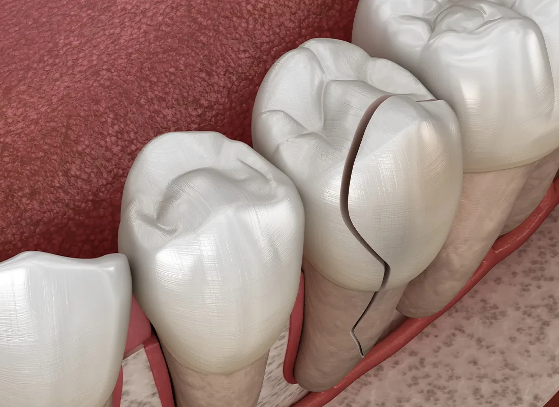 Need Urgent Dental Care? Call Us For A Same-Day Appointment
