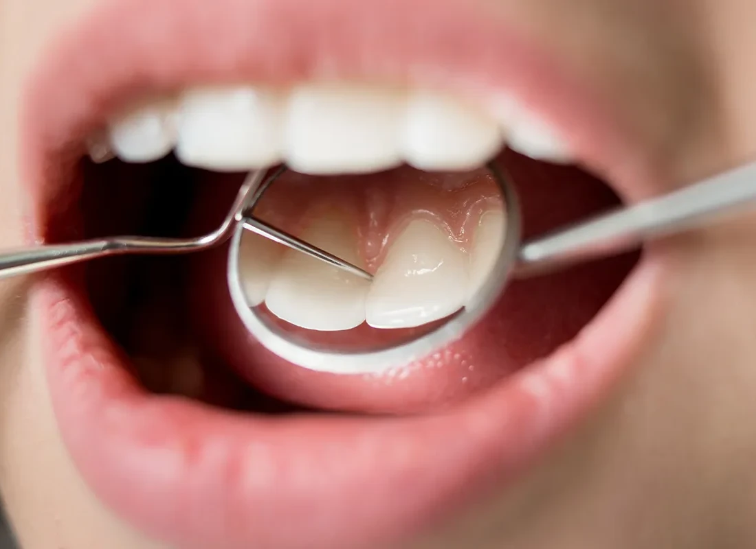 Do You Have Sensitive Teeth?