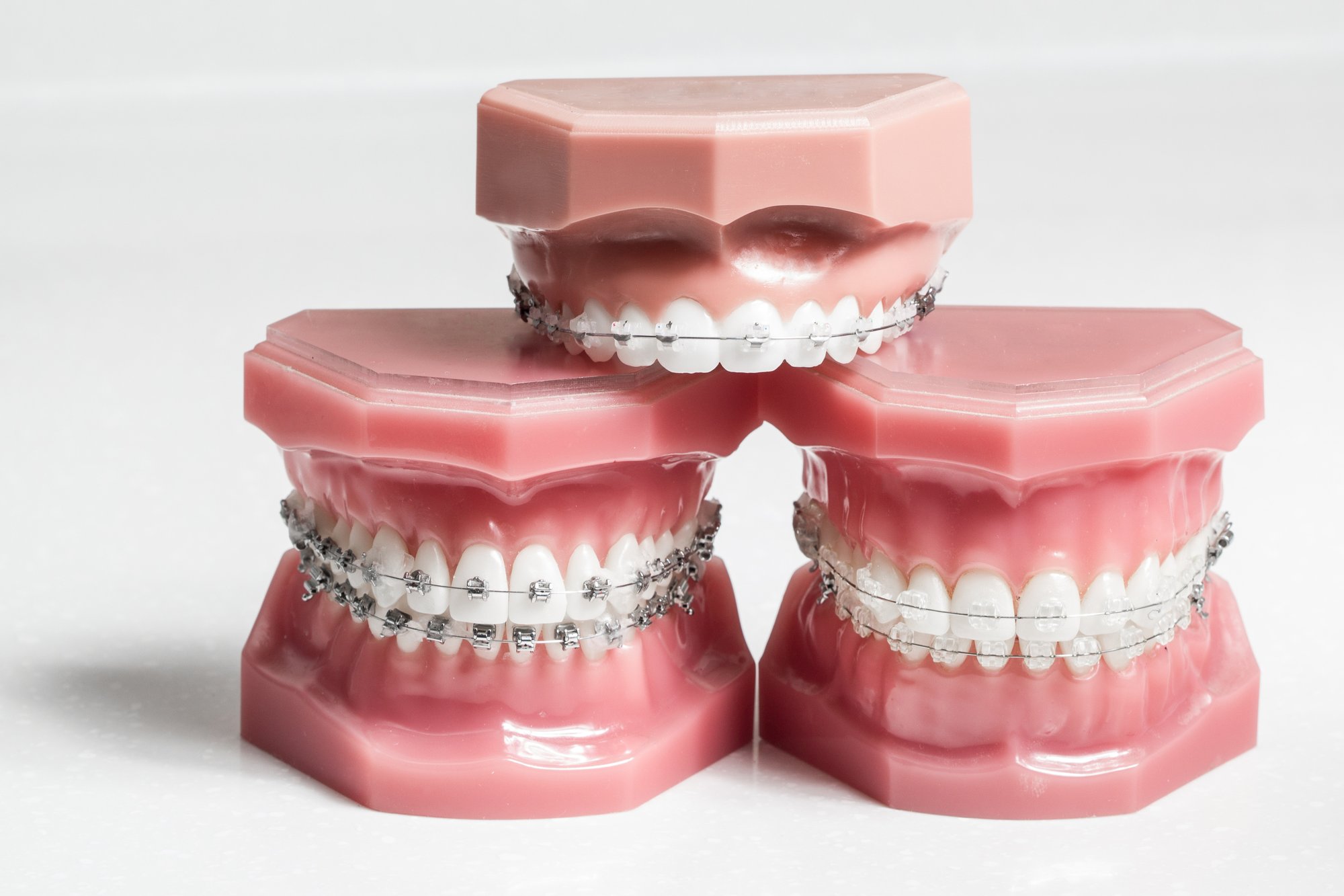 Are You Keeping Up With Your Dental Health?