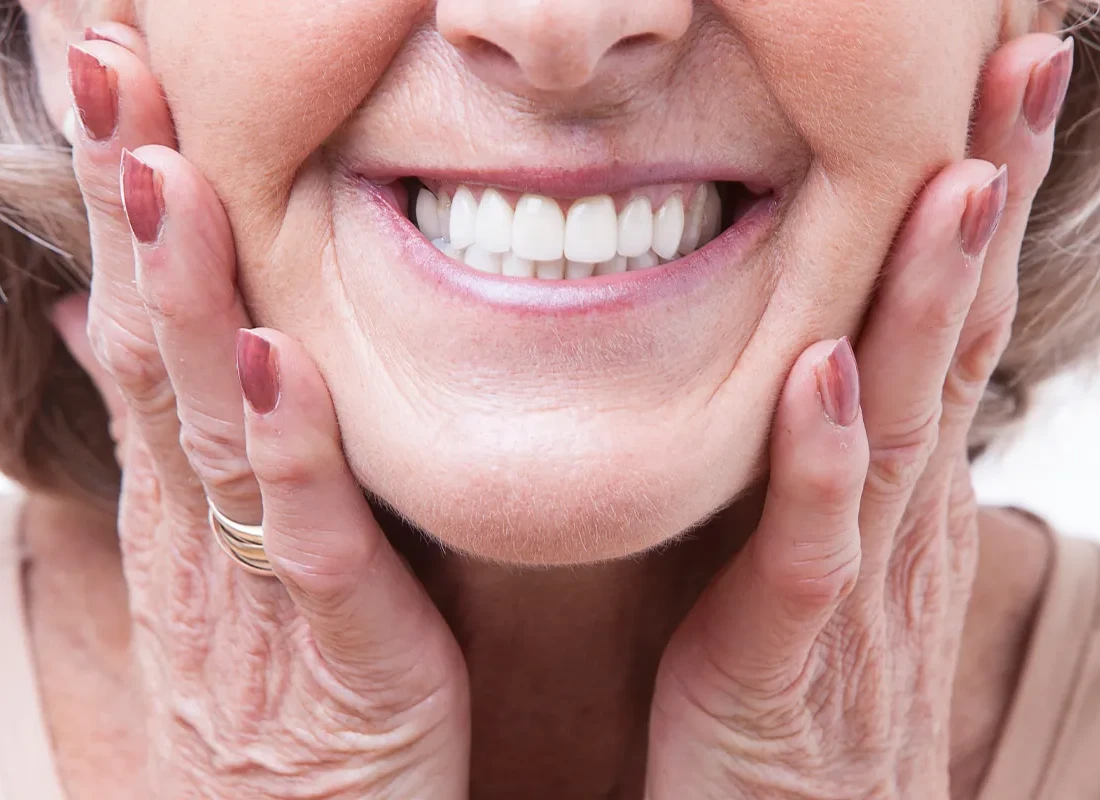 What is All-on-4 Implants