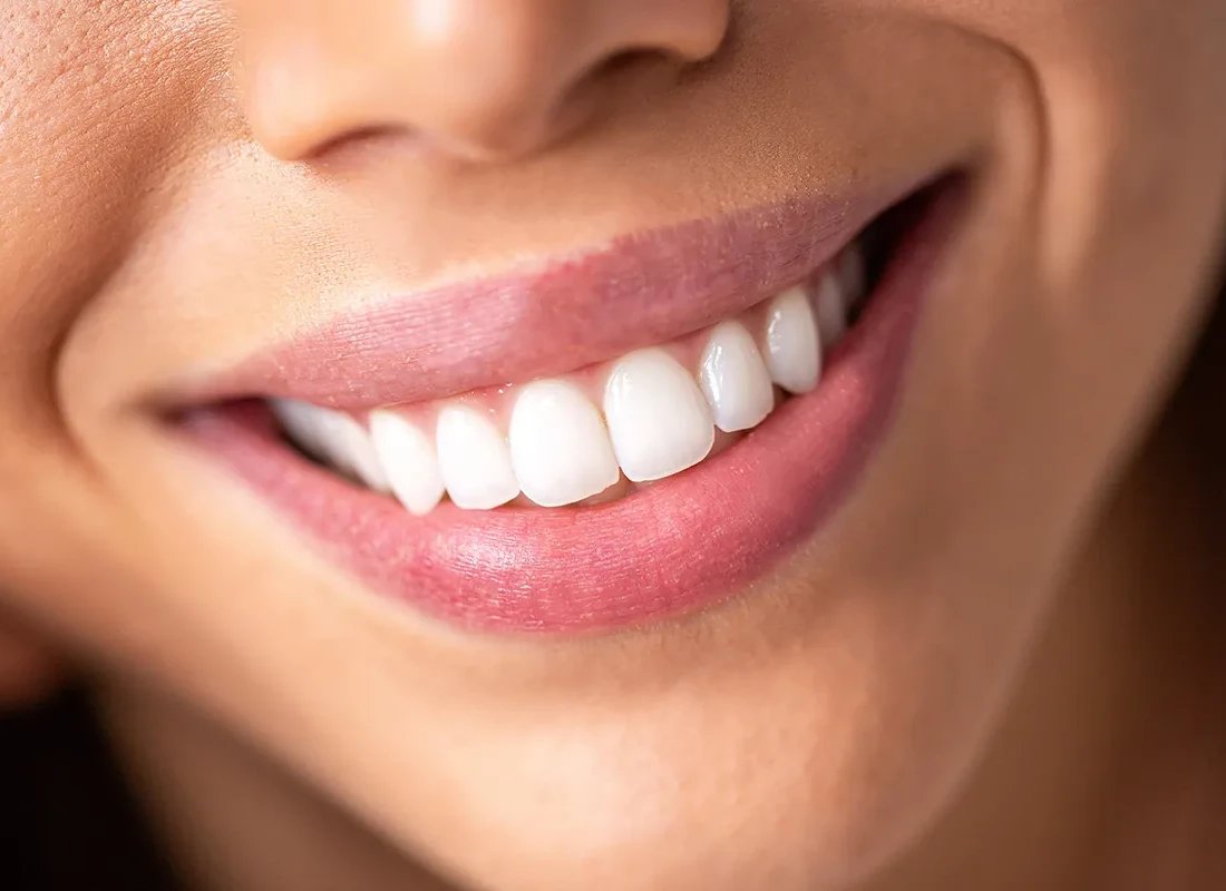 What is Full Mouth Reconstruction