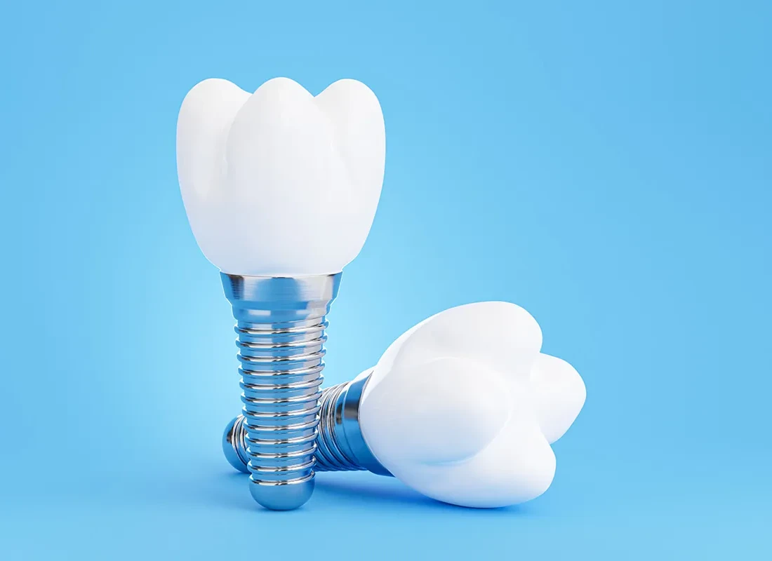 What To Know About Dental Implants