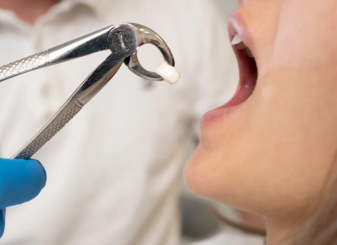 Stop These 3 Habits Now And Save Your Teeth